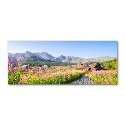 Acrylbild Fotodruck Berghütten